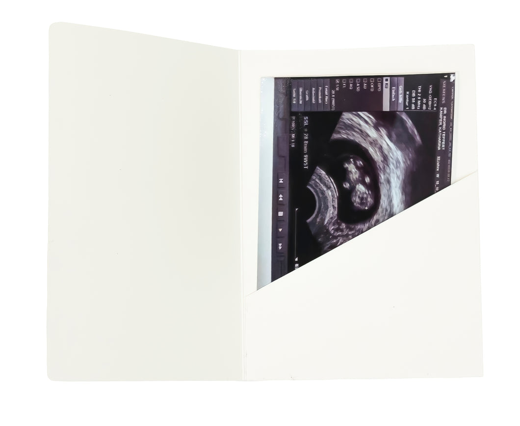 Ultrasound Picture Frame MarlaBox